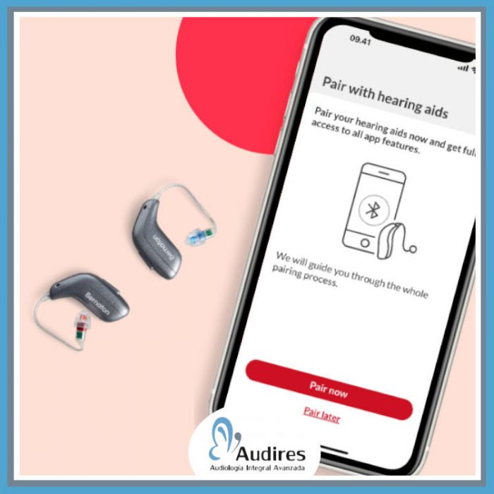 Adaptación Audífonos Audires