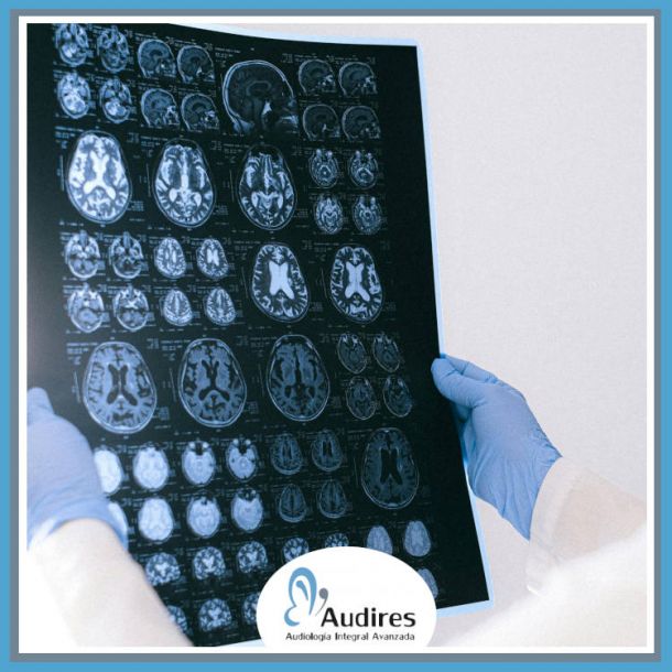 El papel del cerebro en la audición